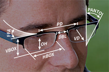 采用个性化参数