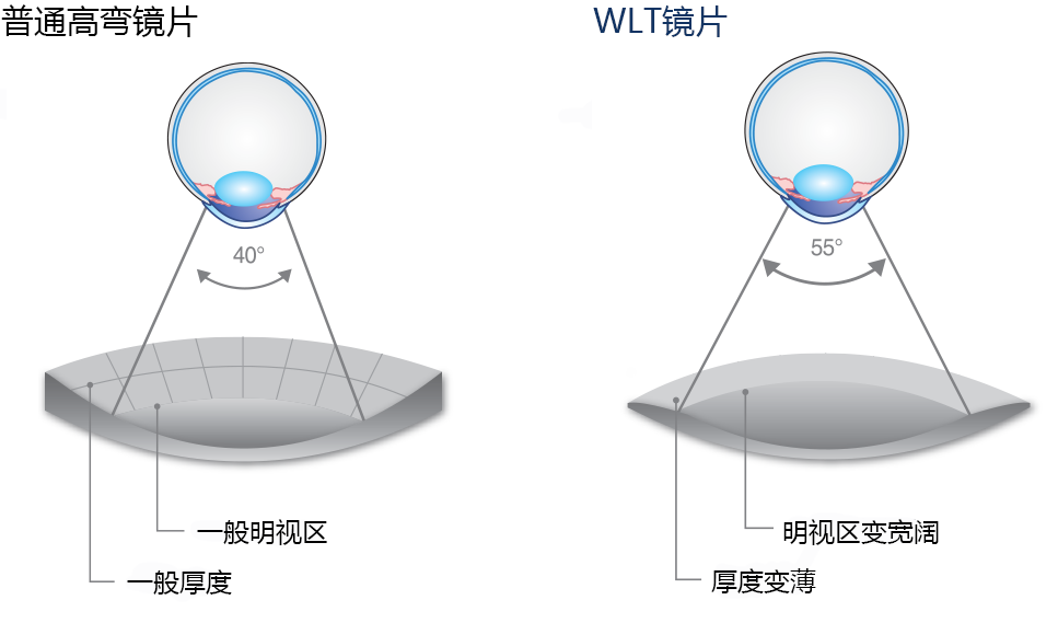 WLT镜片